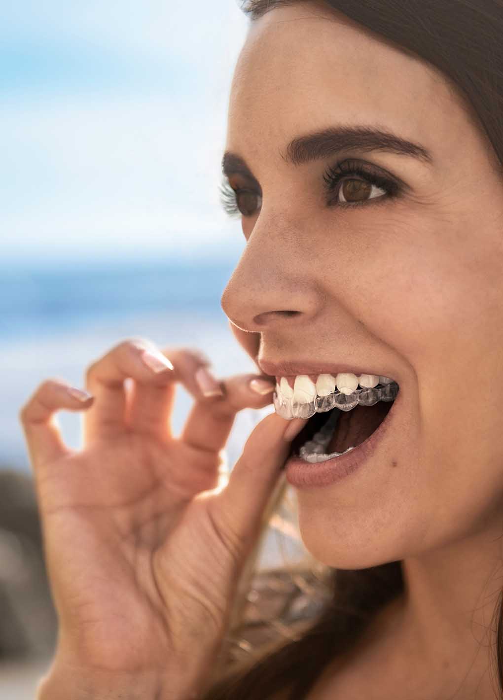Woman with clear braces smiling outdoors with a blurred background
