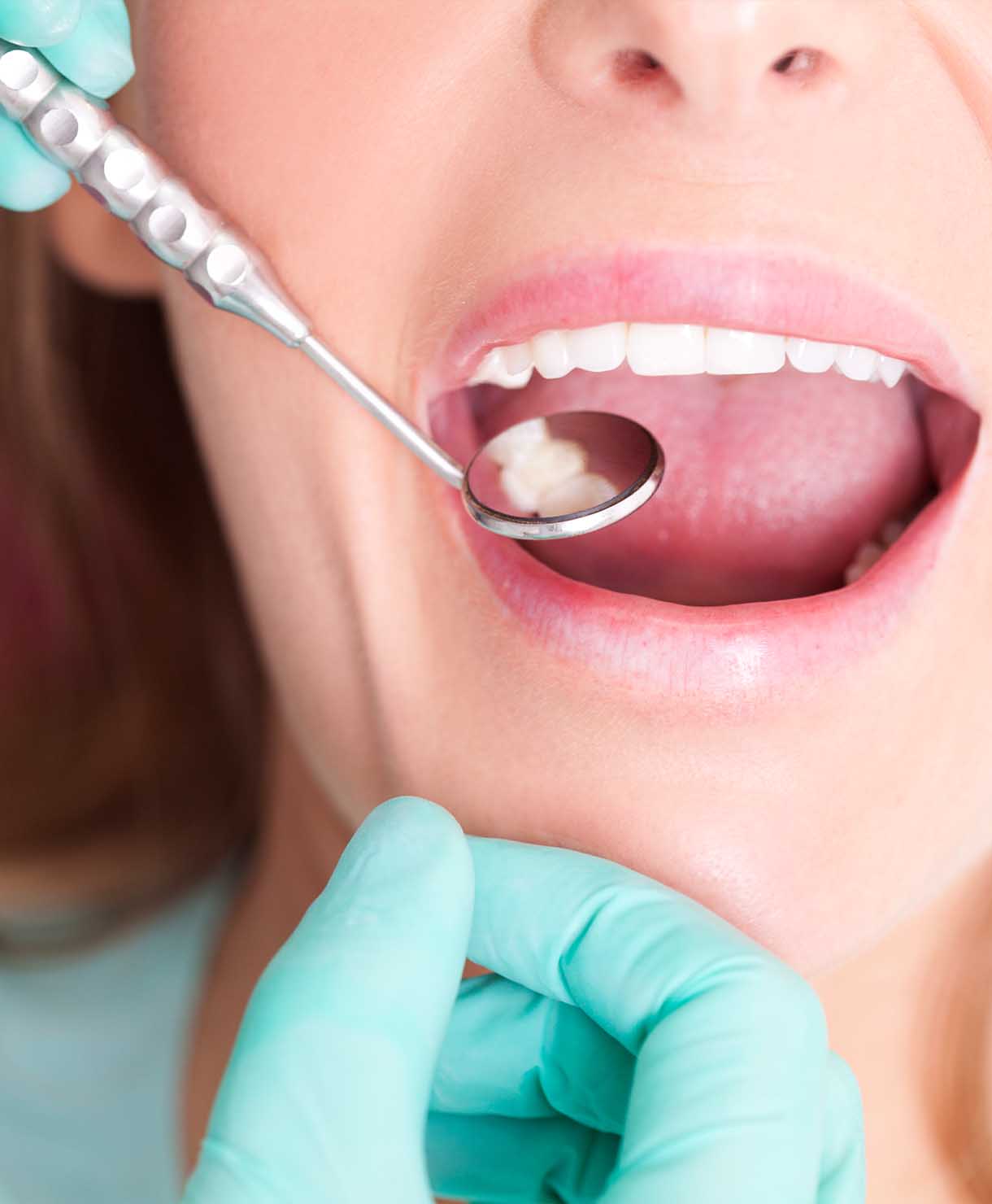 Dental examination with a dental mirror and gloved hands