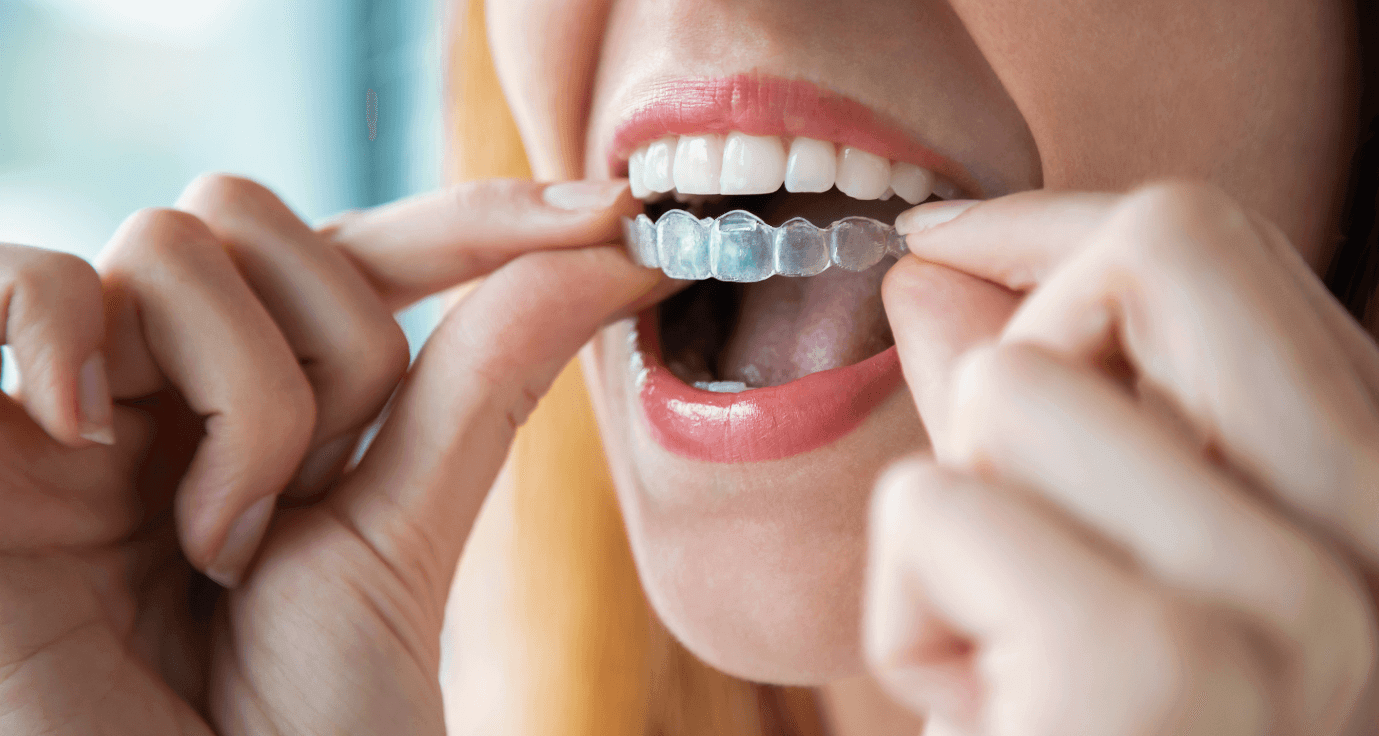 Woman applying Invisalign braces